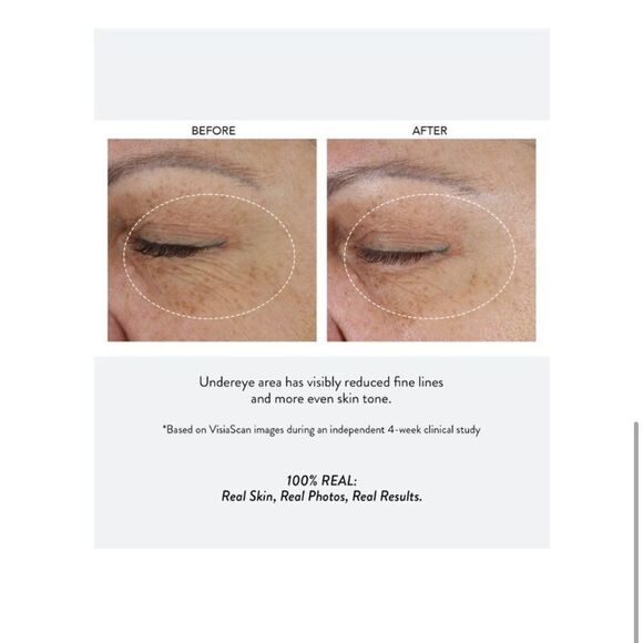 $6 π Peach & Lily RetinolβFor All Pure Peach Retenioc Eye Cream NEW - Picture 5 of 10